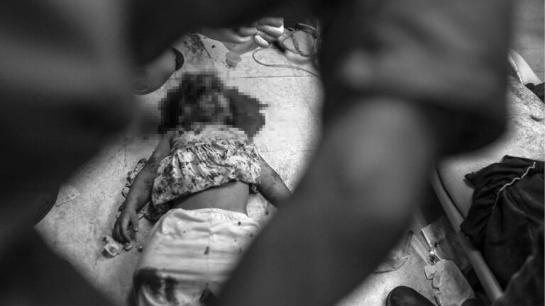 DSÖ: Gazze'de 12 ila 14 bin arasında kritik hastanın tıbbi tahliyeye ihtiyaç duyduğunu tahmin ediyoruz