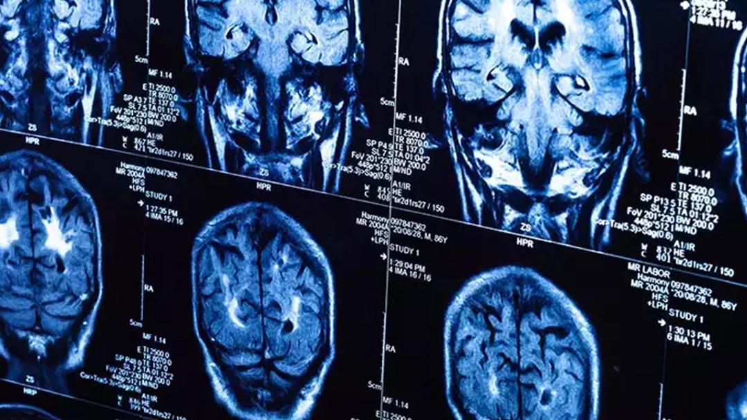 Yıllar sonra Covid Pandema'nın gizli etkisi: Bölgeye çok zarar verdi! Uzmanlar: 