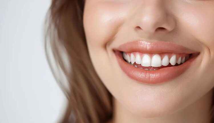 diş beyazlatma, diş beyazlatma fiyatları, gülüş tasarımı (1)